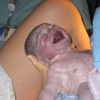 Perawatan-Tali-Pusat-Bayi-Yang-Baru-Lahir