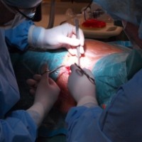 Apa-saja-Bahaya-Keguguran-Tanpa-Kuret