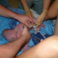 tanda-tanda-akan-melahirkan