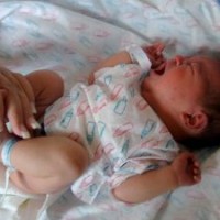 penyakit difteri pada bayi