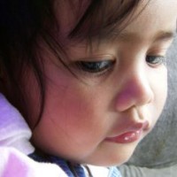 Mengenali Gejala Radang Tenggorokan Pada Balita