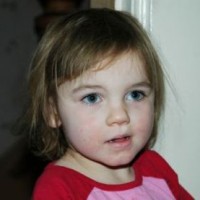 mengenal-perbedaan-cacar-air-varicella-cacar-monyet-variola-cacar-api-herpes