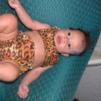 tips-merawat-anak-yang-terkena-cacar