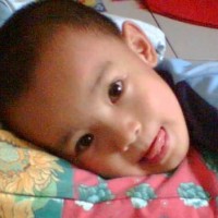 Cara Mengobati Luka Memar Pada Anak