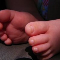 mengenal-episiotomi-dalam-proses-persalinan