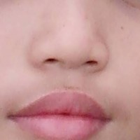 Penyebab Sinusitis pada Anak