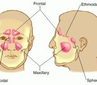 sinus_paranasales