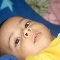 Mengobati Luka Lecet Pada Anak