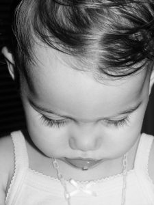 Memahami Pengertian Cradle Crap pada Bayi